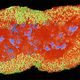 Image for article titled Scary Strain of Gonorrhea Is Resistant To All Known Antibiotics